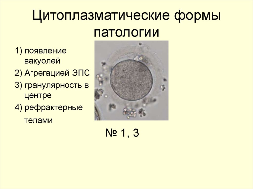 Цитоплазматические формы патологии