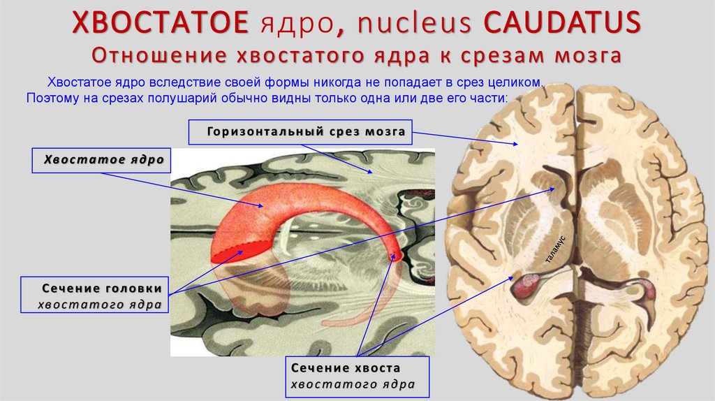 Расширение в базальных ядрах