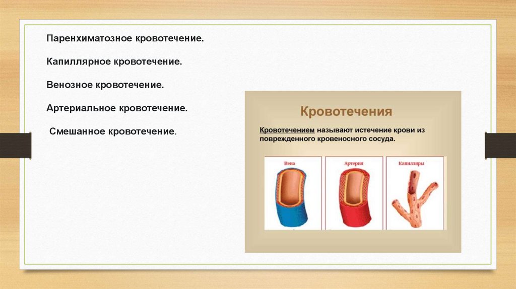 Кровотечения. Виды кровотечений. Первая помощь - презентация онлайн