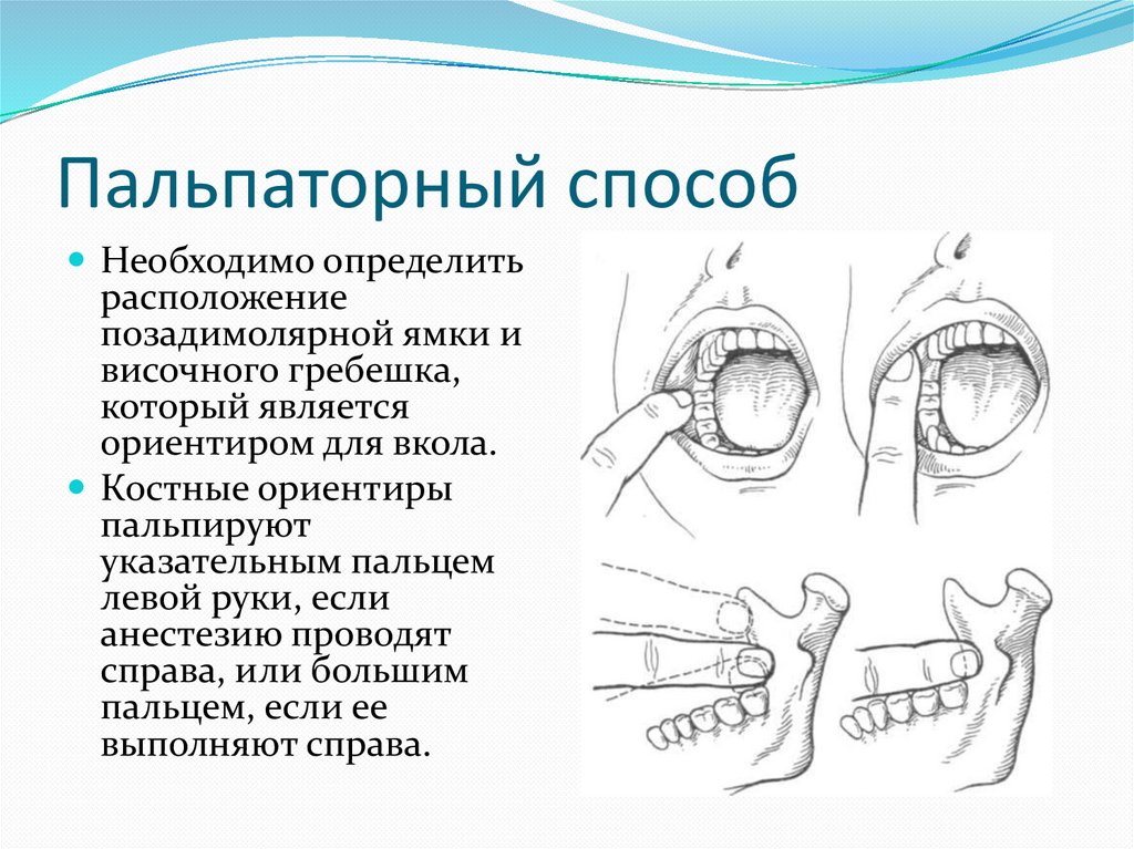 Техника проведения пункции коленного сустава. СИНОВИТ КОЛЕННОГО СУСТАВА | Пункция сустава | Лечение Синовита Методика проведения пункции коленного сустава Топография тазобедренного и коленного сустава. Пункция тазобедренного и.