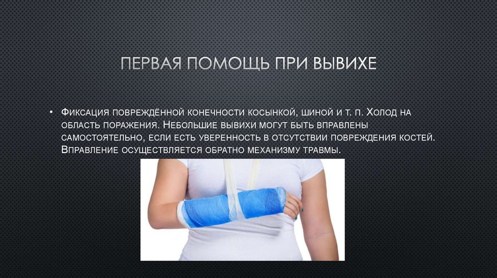 Первая помощь при вывихах и растяжениях - презентация онлайн