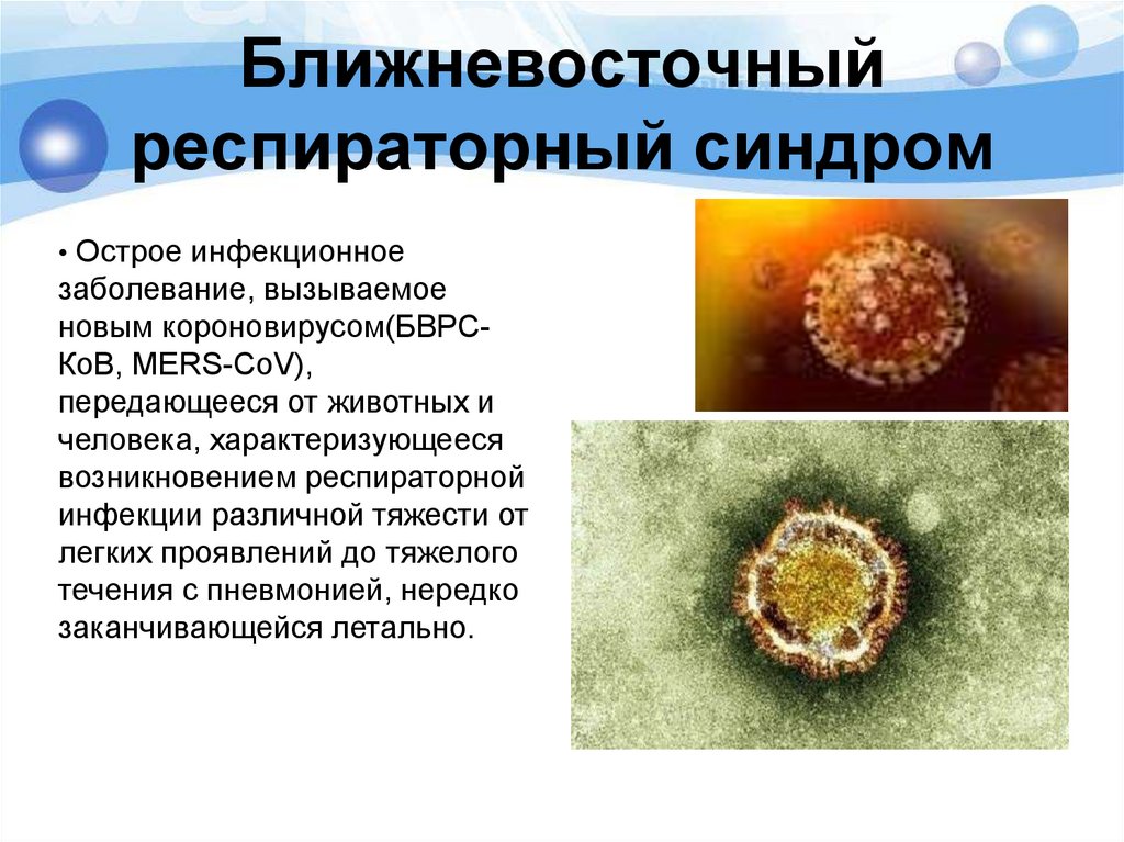 Ближневосточный респираторный синдром