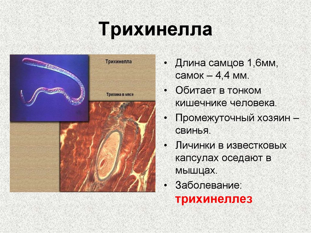 Строение трихинеллы рисунок