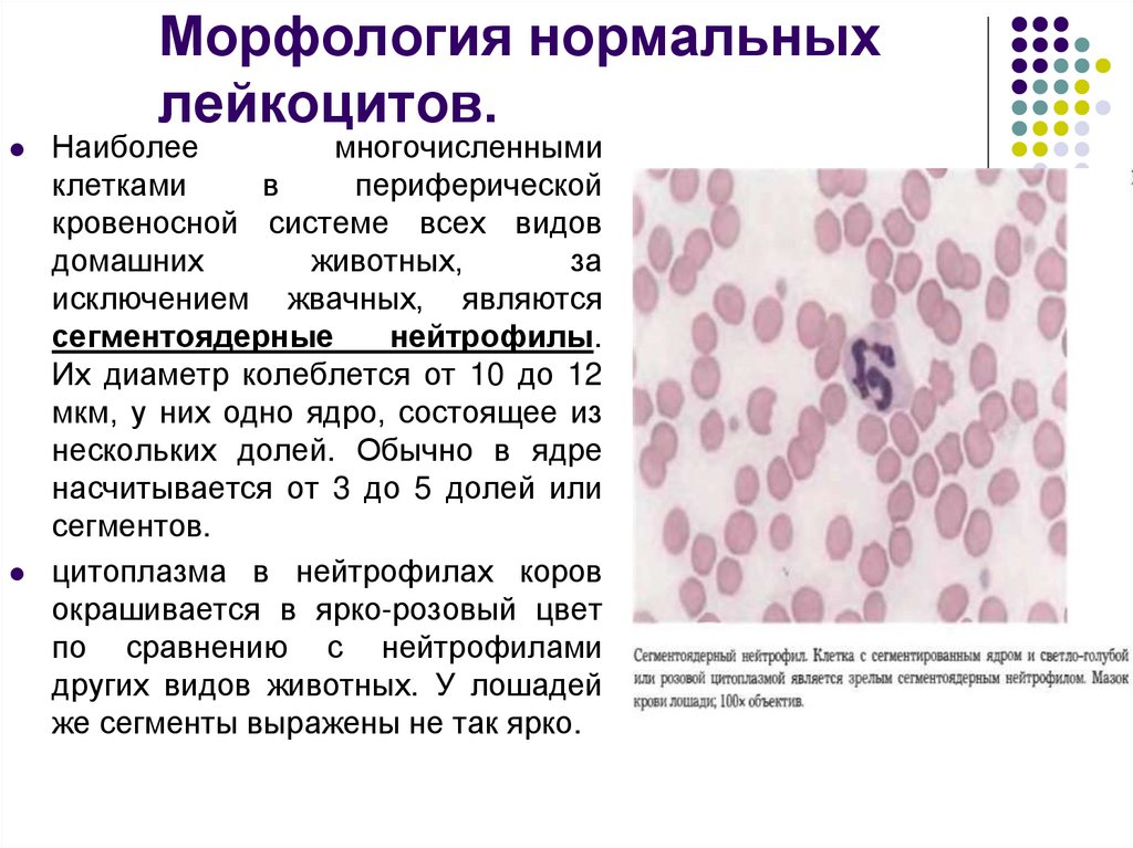Сегментоядерные нейтрофилы в крови что это значит. Палочкоядерный нейтрофил. Лейкоциты моноциты нейтрофилы. Повышение палочкоядерных нейтрофилов. Морфология лейкоцитов крови.