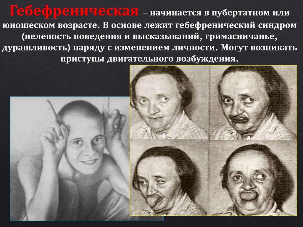 Гебефреническая – начинается в пубертатном или юношеском возрасте. В основе лежит гебефренический синдром (нелепость поведения