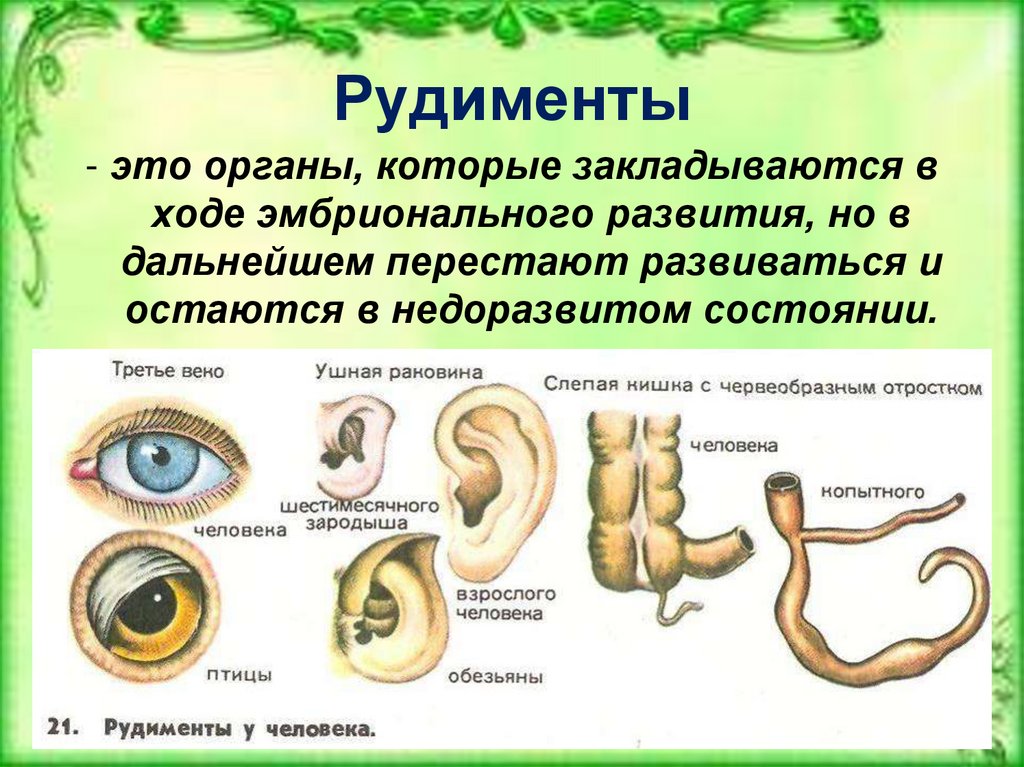 Ушная раковина атавизм. Рудиментарные органы человека. Рудименты доказательства эволюции. Рудиментарные органы пример.