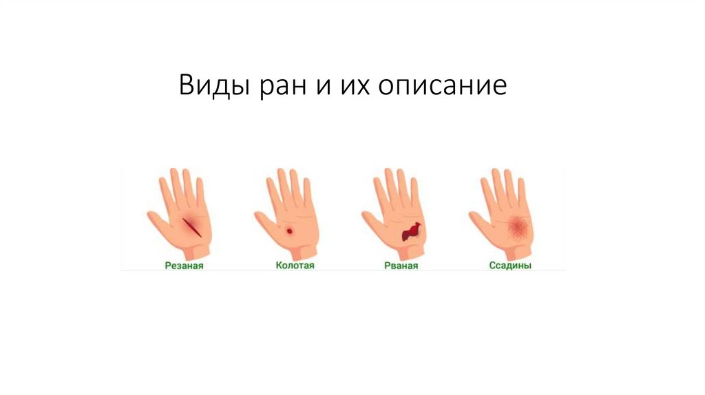 Виды ран и их описание - презентация онлайн