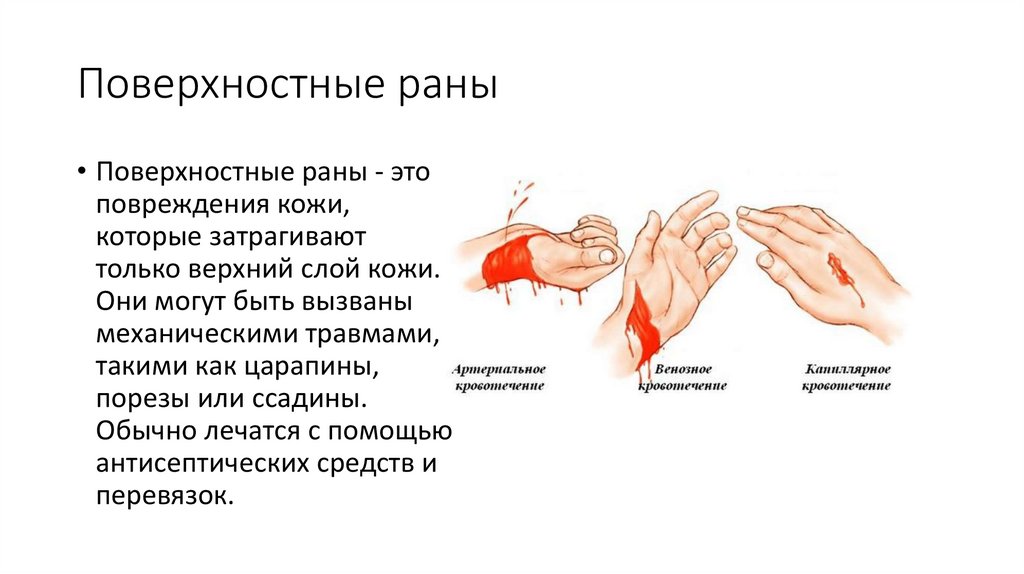 Виды ран и их описание - презентация онлайн