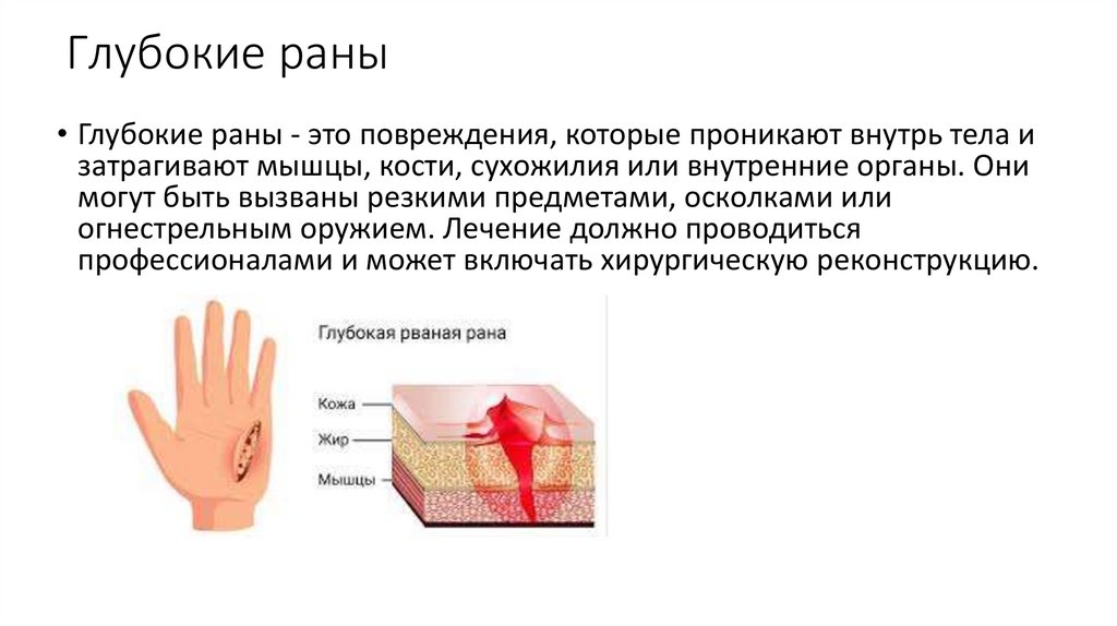 Виды ран и их описание - презентация онлайн