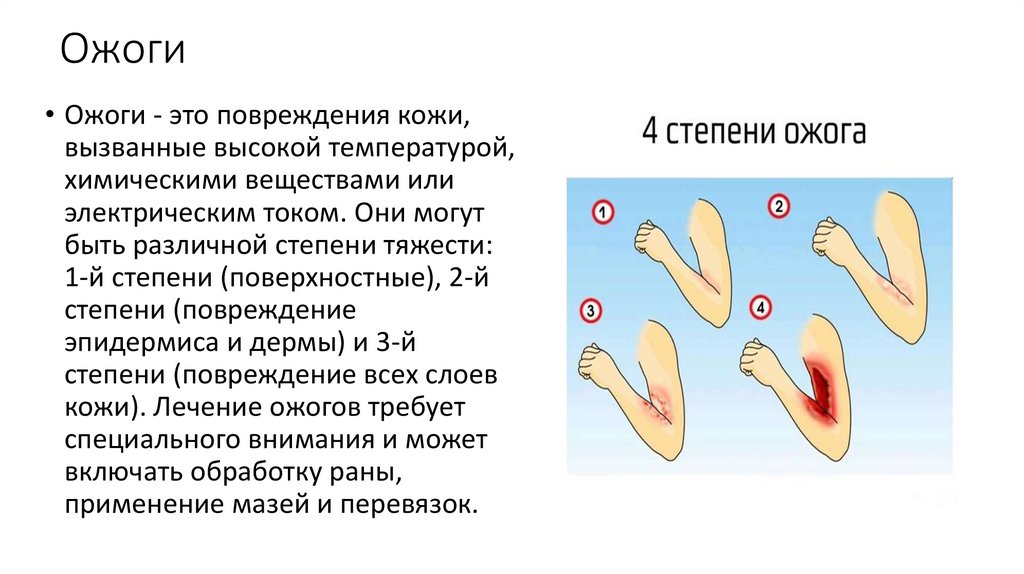 Виды ран и их описание - презентация онлайн