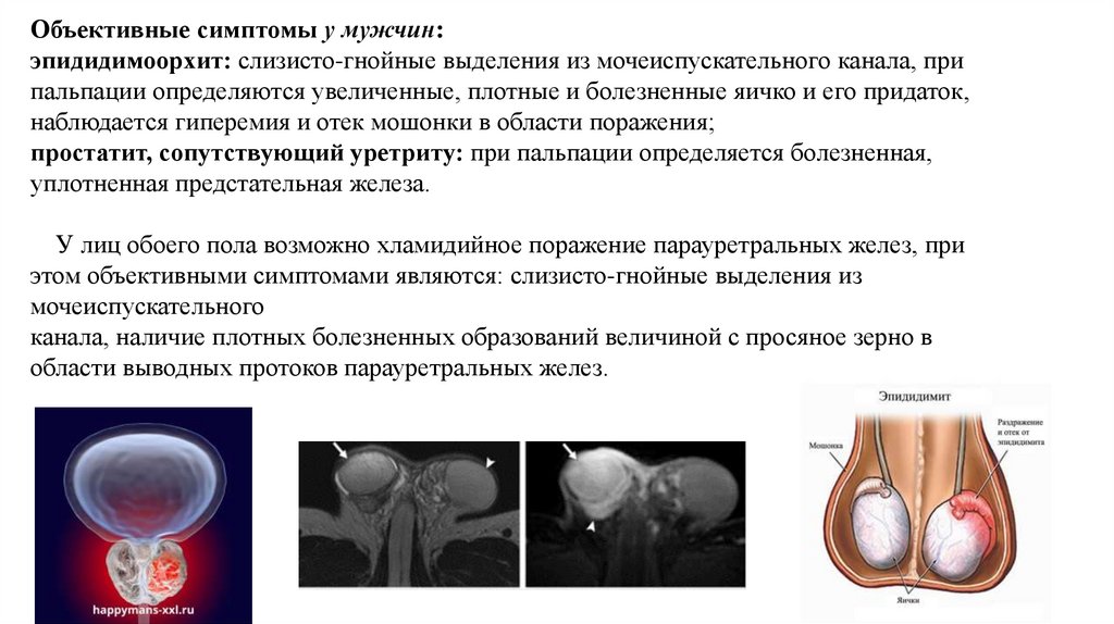 Урогенитальный хламидиоз презентация