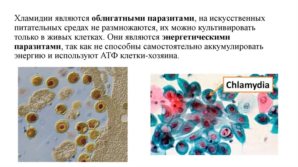 Хламидиоз отрицательный. Хламидиоз презентация. Урогенитальный хламидиоз презентация. Хламидиоз картинки для презентации.