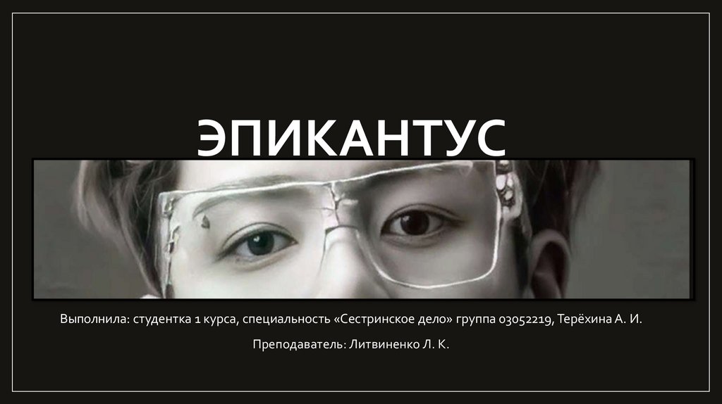 Эпикантус - презентация онлайн