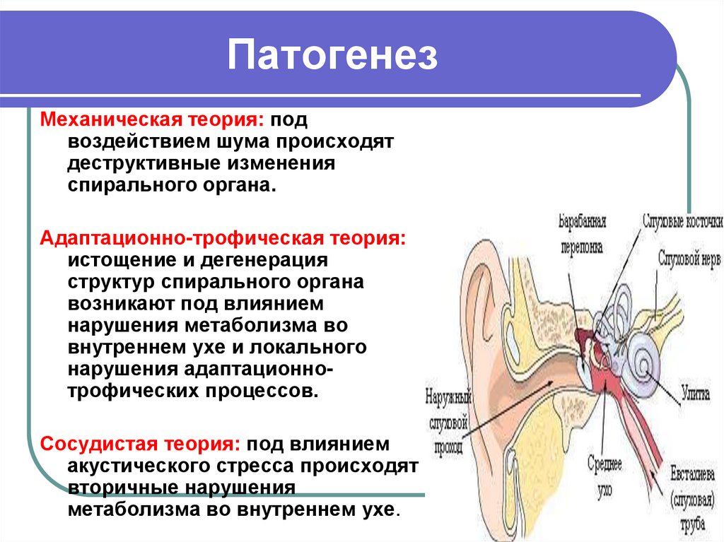 Нейросенсорная тугоухость