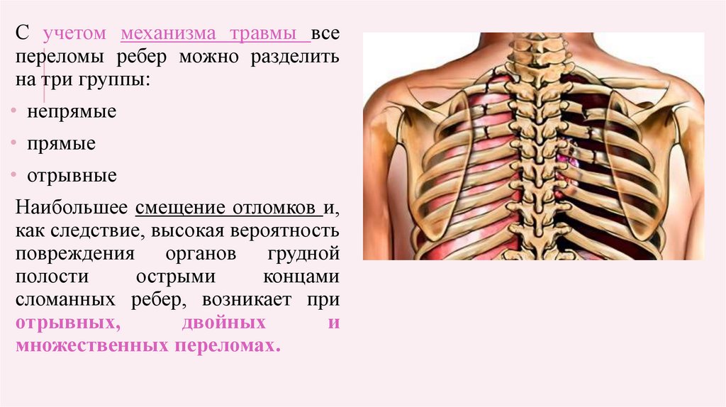 Травма грудной клетки код. Открытые повреждения грудной клетки. Закрытые повреждения грудной клетки. Классификация травм грудной клетки по Вагнеру. Закрытые повреждения груди и живота.