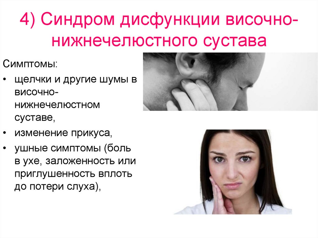 4) Синдром дисфункции височно-нижнечелюстного сустава