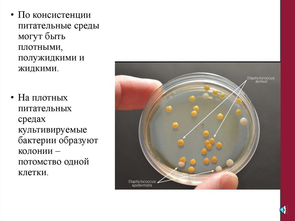 Плотная питательная среда. Плотные питательные среды. Полужидкие питательные среды. Механизмы питания микроорганизмов. Питательные среды по консистенции.