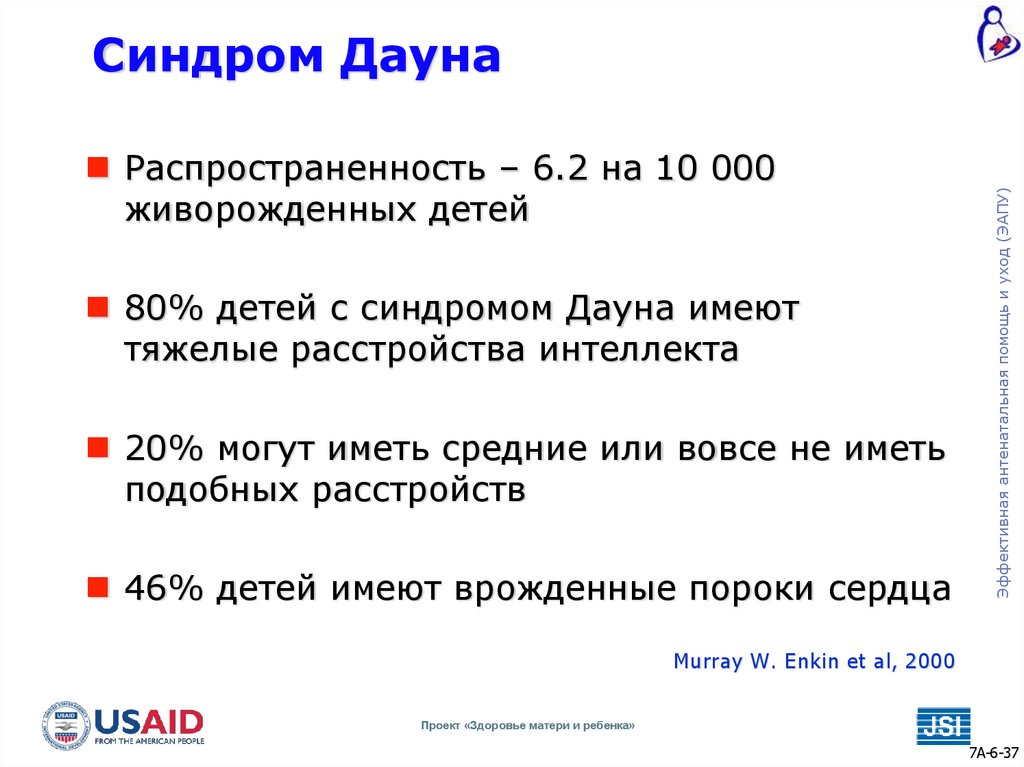 Синдром Дауна