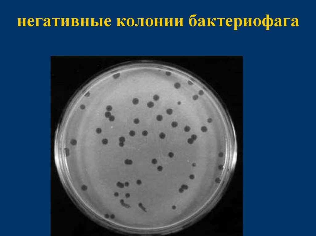 негативные колонии бактериофага