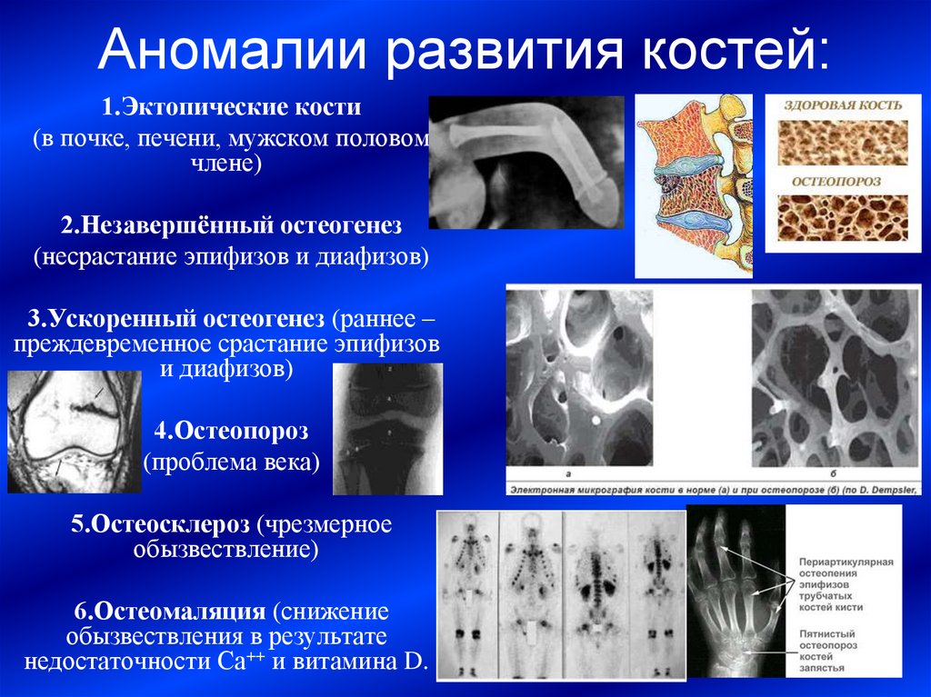 Аномалии развития верхних конечностей презентация