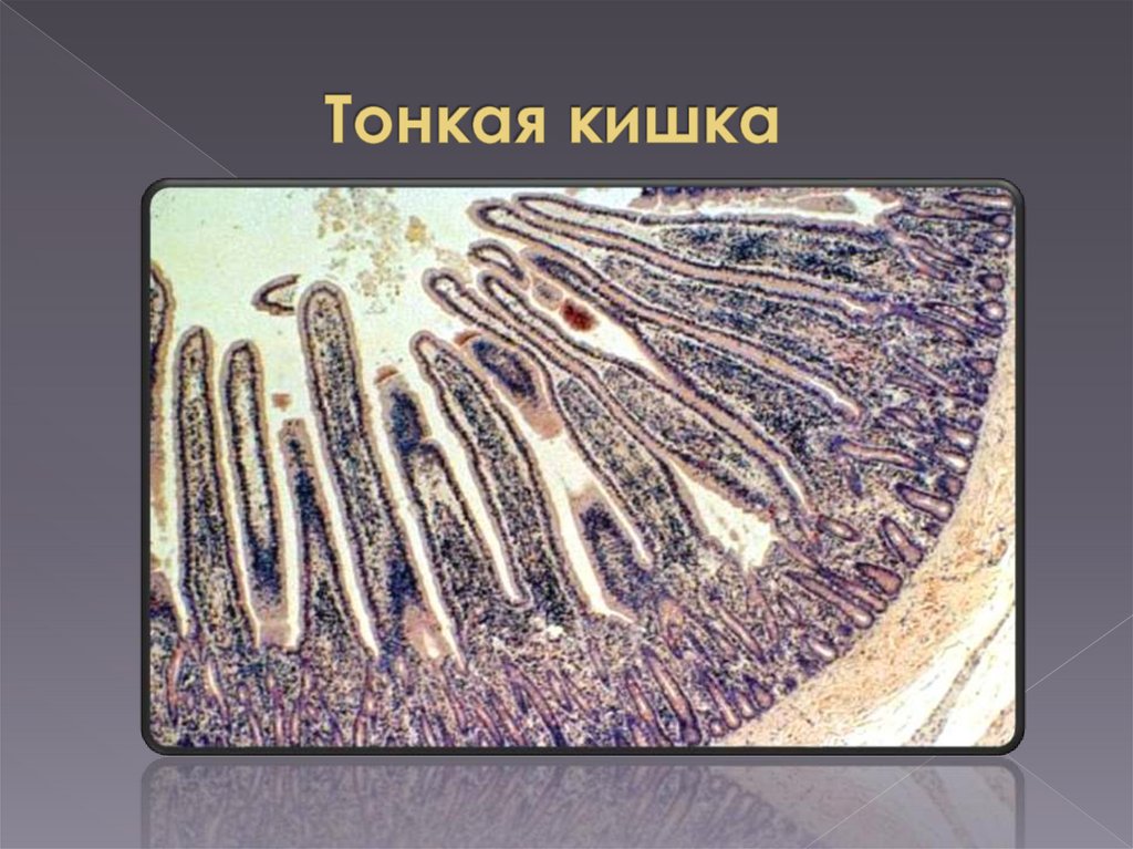 Пищеварительная система. Кишечник - online presentation
