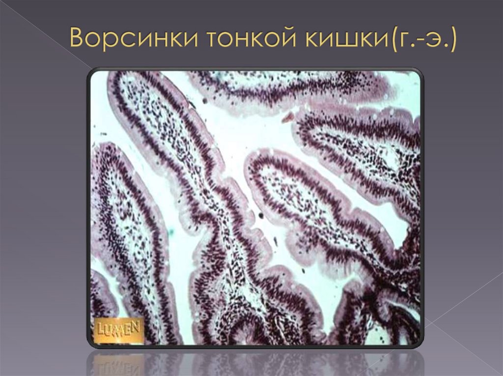 Пищеварительная система. Кишечник - online presentation