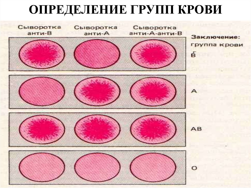 Группы крови и резус-фактор - презентация онлайн
