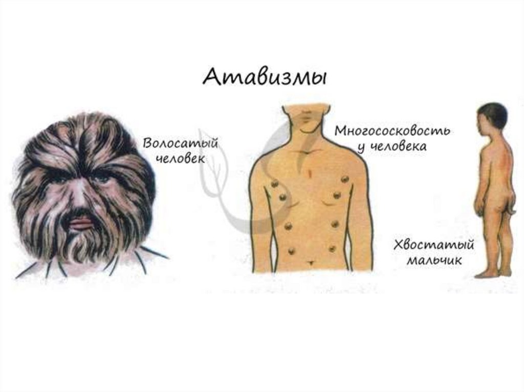 Атавизмы у человека. Атавизмы и рудименты человека. Атавизмы атавизмы случаи.