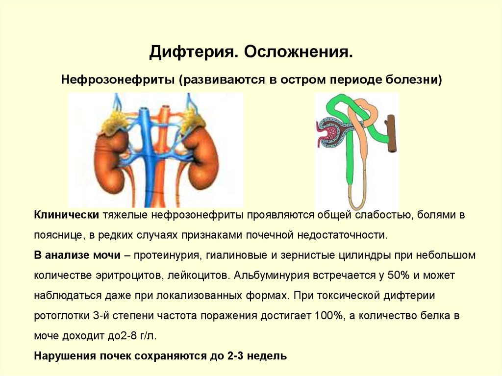 Осложнения дифтерии