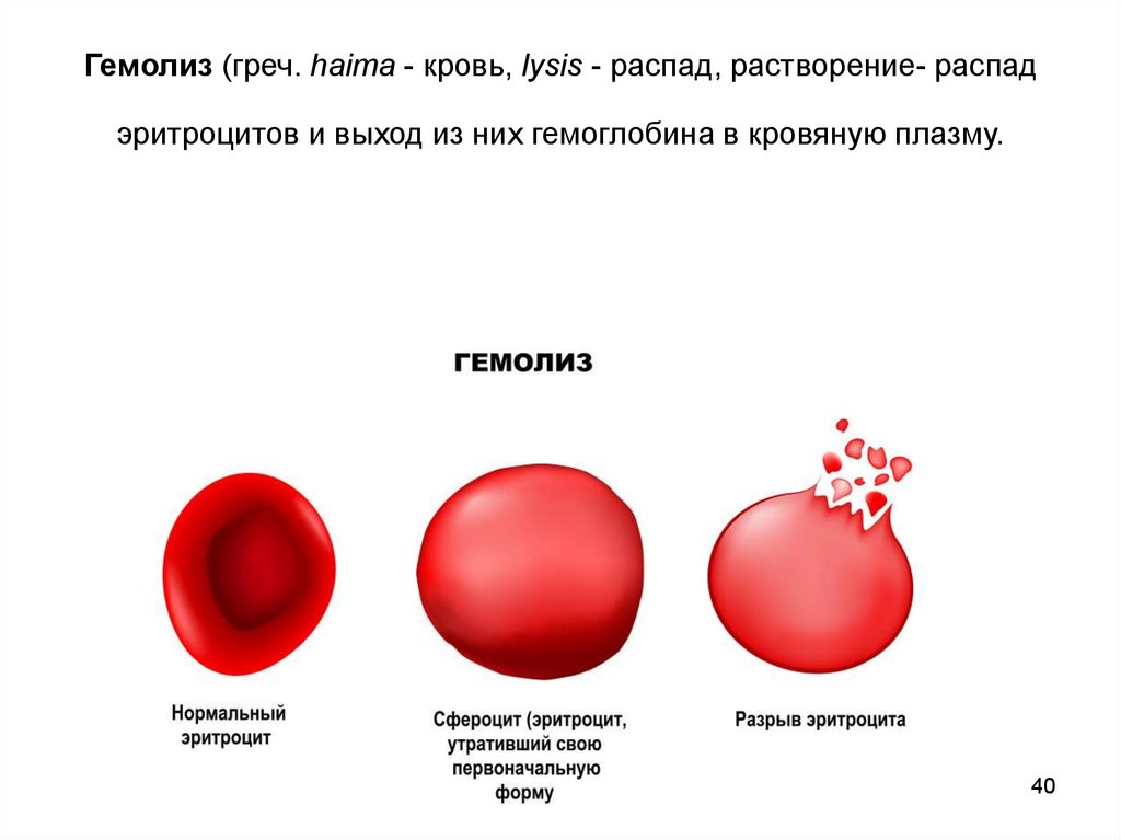 Реакция иммунного гемолиза. Гемолиз. Гемолиз разрушение эритроцитов. Гемолиз эритроцитов симптомы.