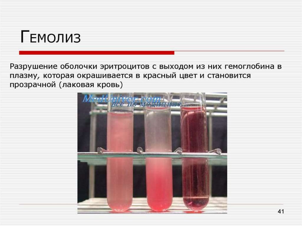 Темно вишневое окрашивание стула характерно для кровотечения. Гемолиз эритроцитов лаковая кровь. Гемолиз эритроцитов анализ крови. Гемолиз разрушение эритроцитов. Признак гемолизированной крови плазма.