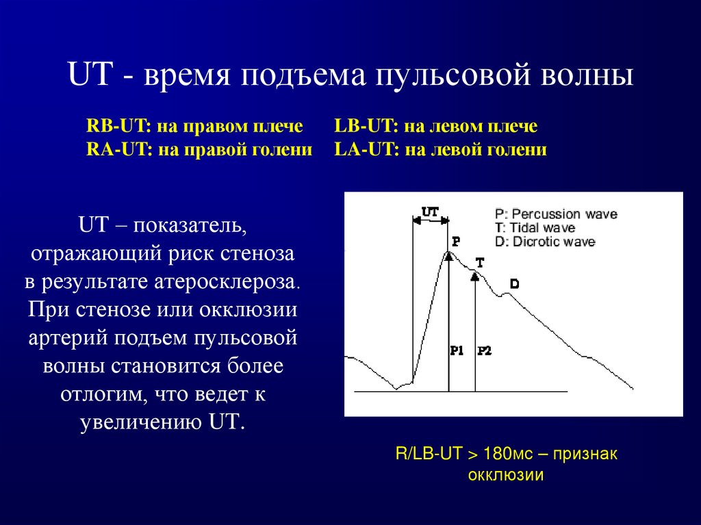 Время подъема. Методы регистрации пульсовой волны. Методы оценки пульсовой волны. Современные методы исследования пульсовой волны.. Высота пульсовой волны.