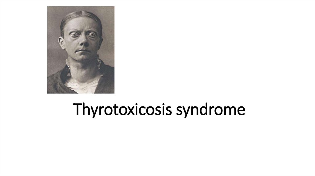 Thyrotoxicosis syndrome