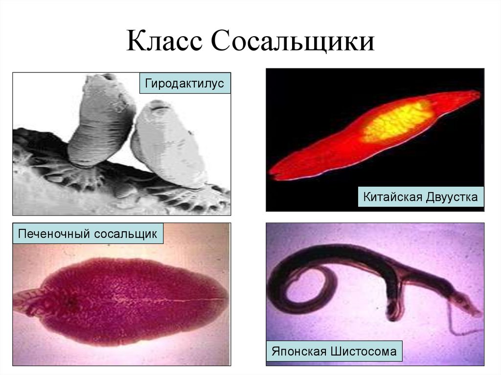 Класс Сосальщики (Trematoda)