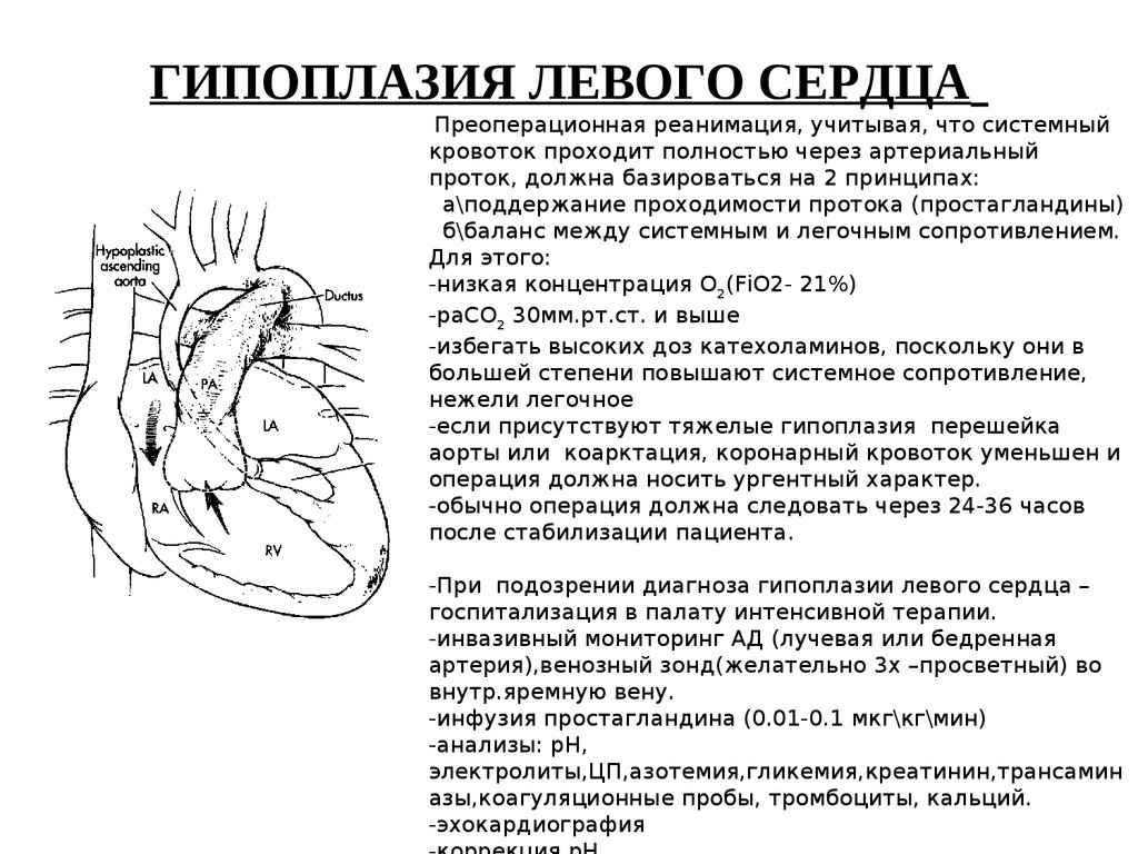 Разрыв межжелудочковой перегородки. Гипоплазия левого сердца.