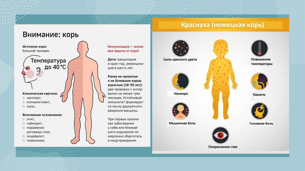 Основные методы от краснухи паротита кори