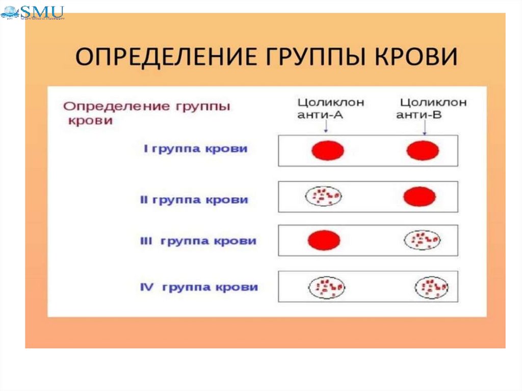 Цоликлоны для определения группы крови. Определение группы крови цоликлонами алгоритм. Планшет для определения группы крови. Ошибки Цоликлоны.