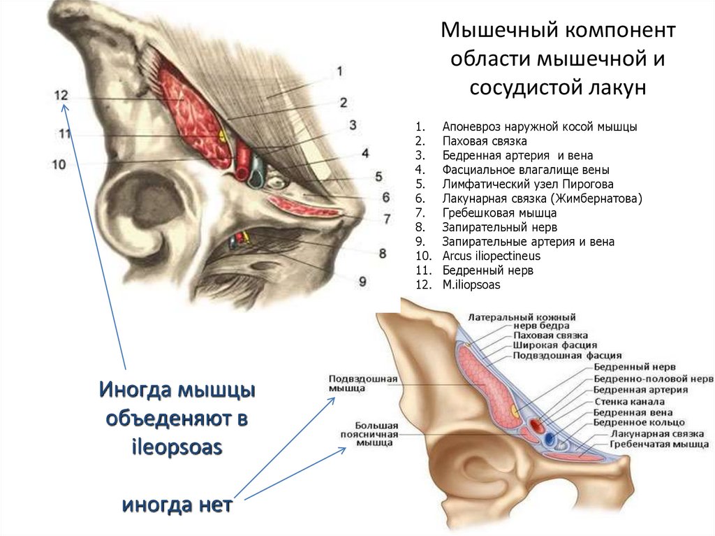 Мышечная лакуна на бедре