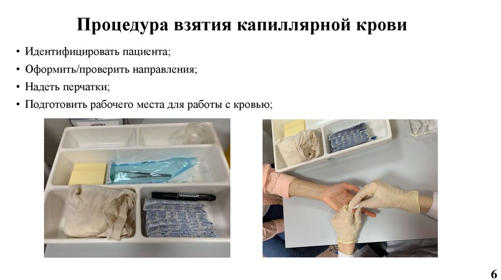 Процедура взятия капиллярной крови