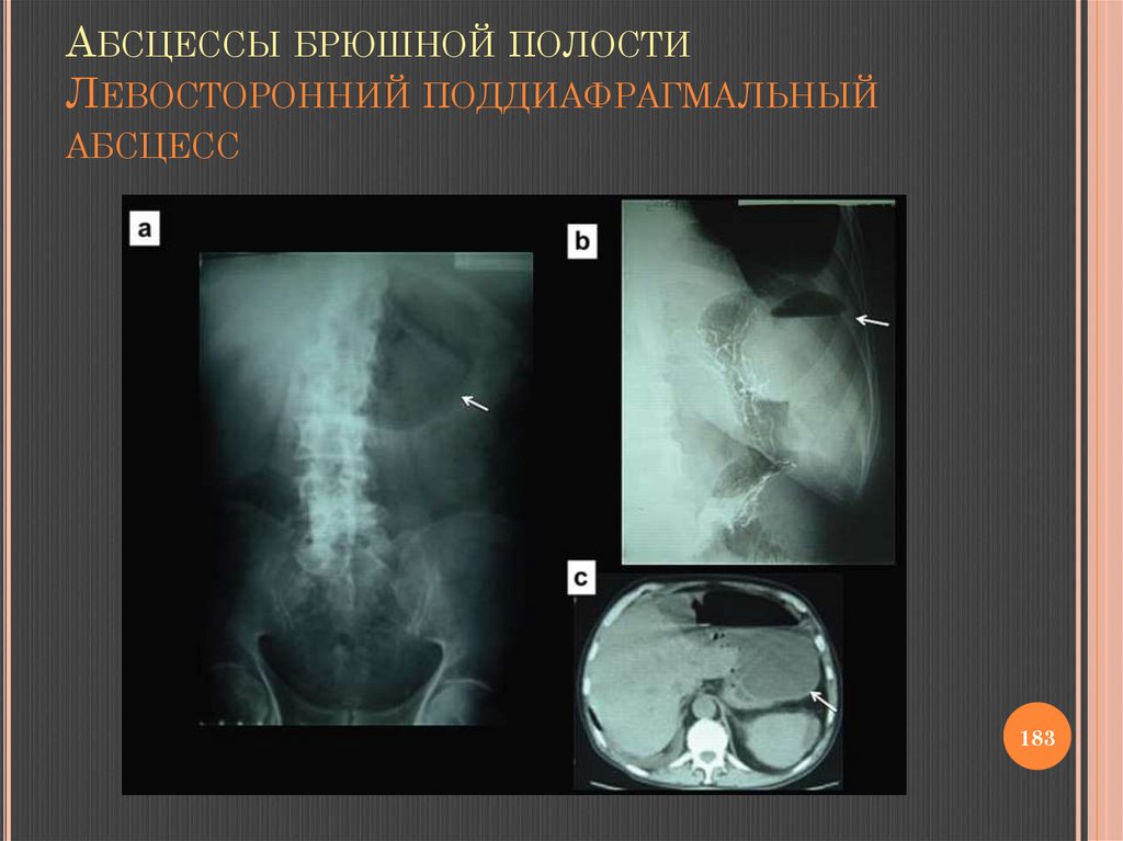 Лучевая диагностика брюшной полости презентация