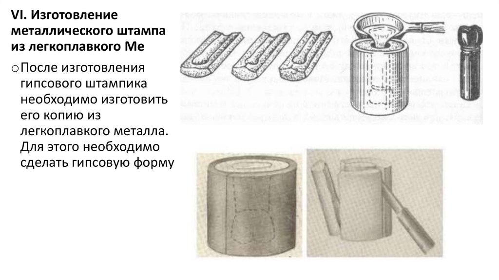 Этапы изготовления штампованной металлической коронки