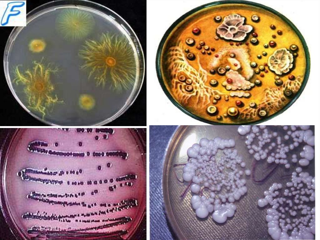 Жива культура бактерии. Клонирование бактерий. Бактерии гниения. Культивирование чумного микроба. Серийные разведения микроорганизмов.
