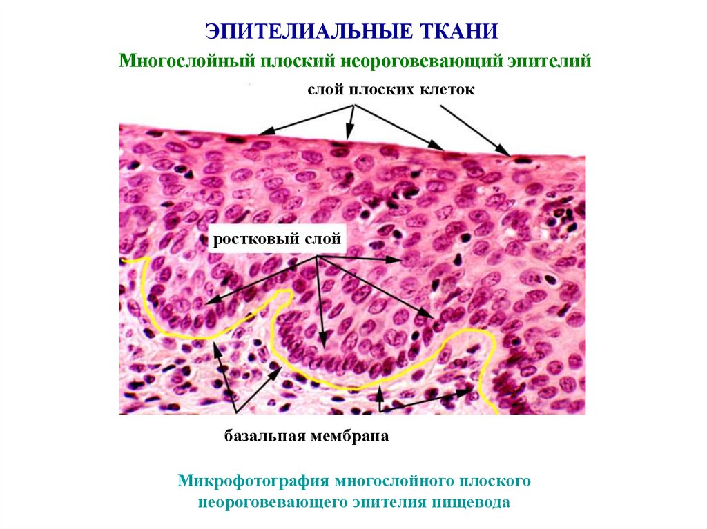 Эпителиальной клеткой является. Базальная мембрана гистология. Многослойный плоский неороговевающий эпителий гистология. Гистология ткани эпителия. Строение эпителиальной ткани гистология.