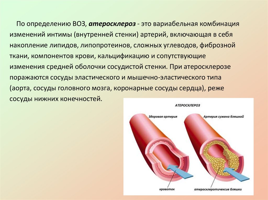 Презентация гиполипидемические средства