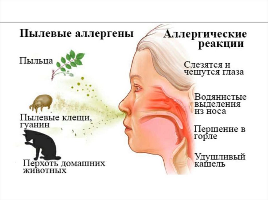 Пыл какой. Аллергия на домашнюю пыль. Аллергические заболевания. Аллергия на пыль симптомы. Аллергия на пыль проявления.