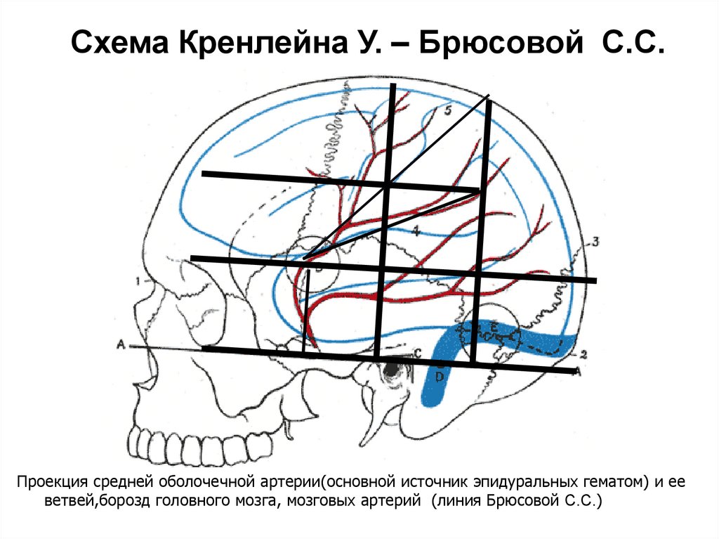 Черепно мозговая топография кренлейна