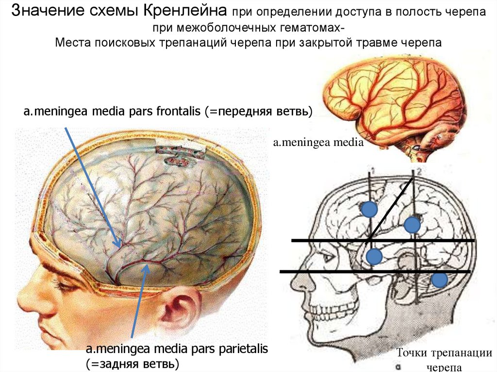 Схема черепно мозговой топографии кренлейна