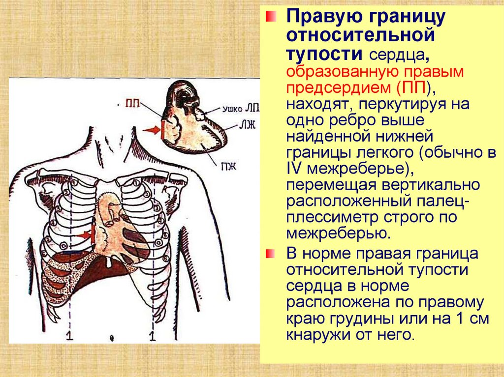 Верхняя граница см. Правая граница относительной тупости сердца в норме. Границы относительной тупости сердца в норме. Границы относительной тупости сердца перкуссия. Границы относительной сердечной.