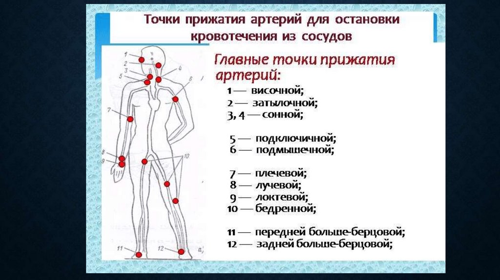 Укажите место человека. Точки пальцевого прижатия артерий для остановки кровотечения. Схема прижатия артерий при кровотечении. Места прижатия артерий при кровотечениях схема. Точки пальцевого прижатия артерий при кровотечении.