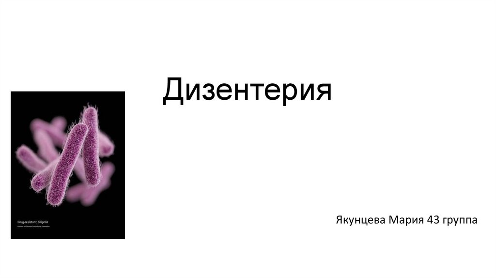 Дизентерия. Диагностика и лечение - online presentation